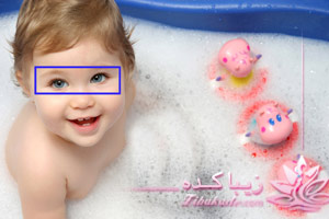 حمام، چشم، انحراف