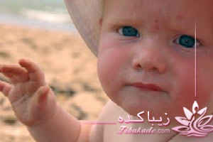 تاول، سوختگی، پوست