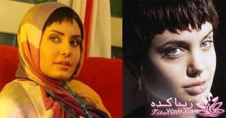 قبل و بعد از عمل بازیگران ایرانی