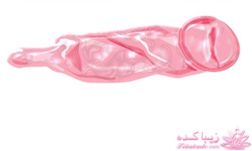 کاندوم - کاندوم زنانه در ایران برای نخستین بار