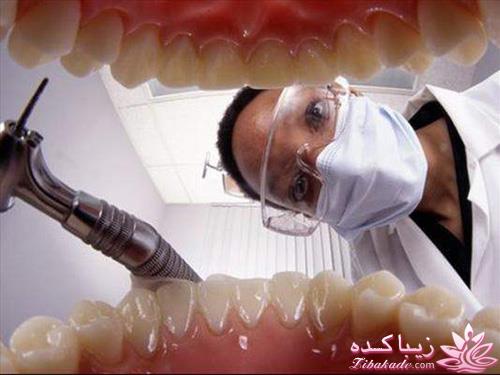 دندانپزشک خوب یا مواد دندانپزشکی خوب