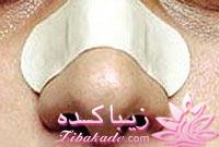 جراحی بینی ، عمل زیبایی بینی