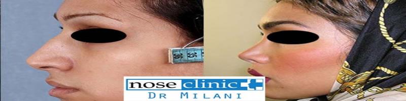 کاور متخصص گوش و حلق و بینی