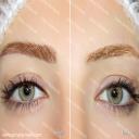 نمونه کارهای میکروپیکمنتیشن