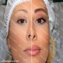 نمونه کارهای میکروپیکمنتیشن