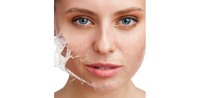 پیلینگ_(لایه_برداری)_در_خانه_بدون_آسیب_رساندن_به_پوست