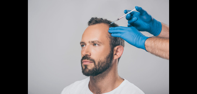 اگزوزوم_تراپی_مو:_جدیدترین_روش_علمی_و_تخصصی_درمان_ریزش_مو_در_مرکز_زیبایی_دکتر_کیان‌پیشه