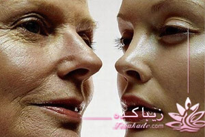 پوست، کلاژن، الاژن، نرم