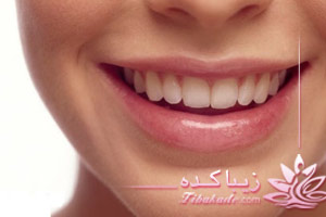 دندان، سفید