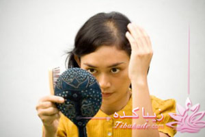 ریزش، مو، سر، کچلی، تقویت، ویتامینه