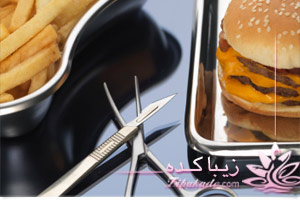 عمل جراحی لاغری