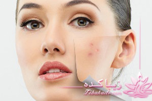 ماسک، نشاسته، صورت، پاکسازی