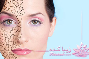 مرطوب، کننده، پوست