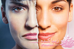 اختلال، دوقطبی