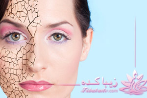 خشکی، پوست، کرم، خانگی، ماسک، شیمیاییی