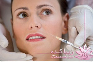 بوتاکس , جراحی , زیبایی