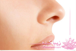 عمل بینی , زیبایی