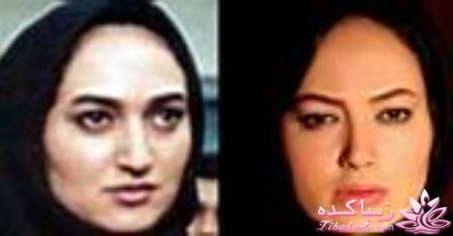 قبل و بعد از عمل بازیگران ایرانی