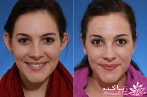 معرفی بهترین کلینیک زیبایی - بهترین دکتر جراح زیبایی