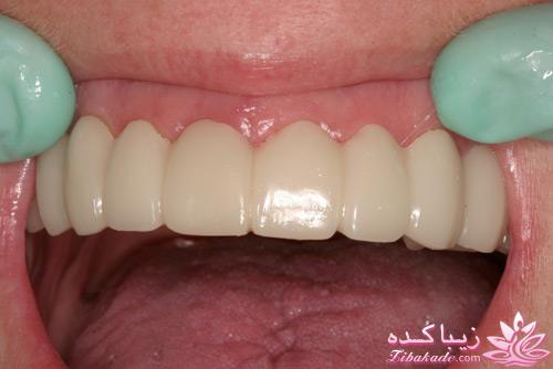 كلينيك زيبايى و ليزر دندانپزشكى دكتر ميرزائى