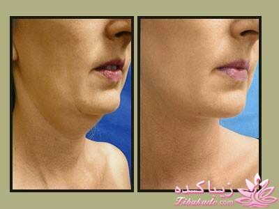 معرفی بهترین کلینیک زیبایی - بهترین دکتر جراح زیبایی