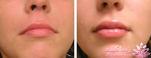 معرفی بهترین کلینیک زیبایی - بهترین دکتر جراح زیبایی