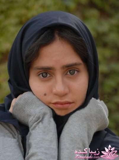 قبل و بعد از عمل بازیگران ایرانی