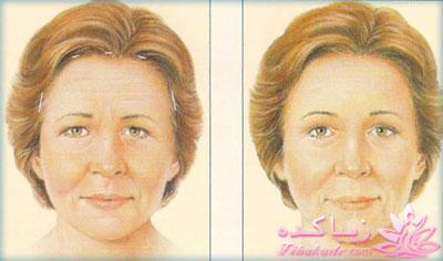 معرفی بهترین کلینیک زیبایی - بهترین دکتر جراح زیبایی