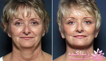 معرفی بهترین کلینیک زیبایی - بهترین دکتر جراح زیبایی