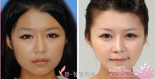 نبوغ کره ای ها در جراحی زیبایی!!!!!!!!!!!!!!!!