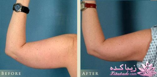 معرفی بهترین کلینیک زیبایی - بهترین دکتر جراح زیبایی