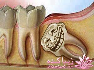 ترول های خنده دار | ترول های جدید 