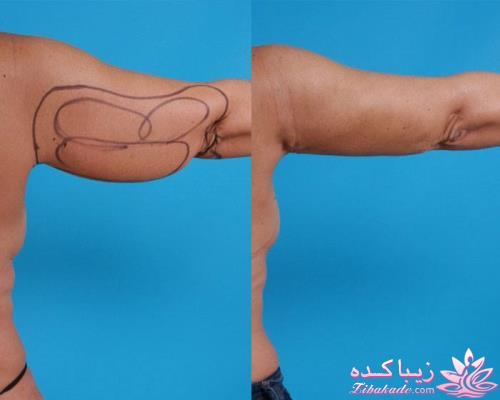 معرفی بهترین کلینیک زیبایی - بهترین دکتر جراح زیبایی