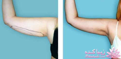 معرفی بهترین کلینیک زیبایی - بهترین دکتر جراح زیبایی