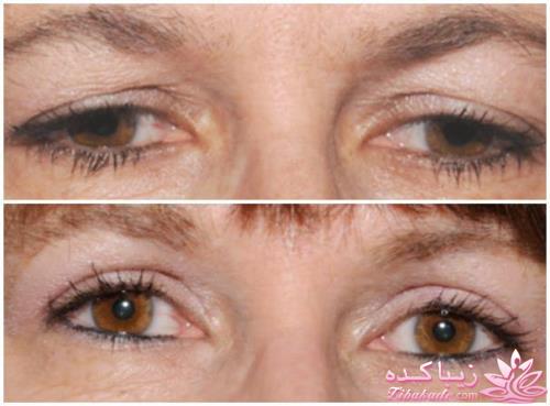 معرفی بهترین کلینیک زیبایی - بهترین دکتر جراح زیبایی