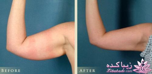 معرفی بهترین کلینیک زیبایی - بهترین دکتر جراح زیبایی