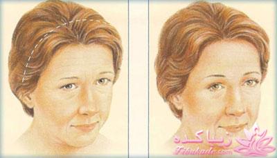 معرفی بهترین کلینیک زیبایی - بهترین دکتر جراح زیبایی