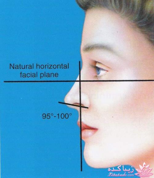 جراحی بینی - جراحی زیبایی