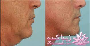 معرفی بهترین کلینیک زیبایی - بهترین دکتر جراح زیبایی