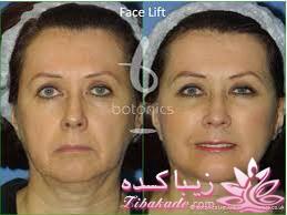 معرفی بهترین کلینیک زیبایی - بهترین دکتر جراح زیبایی