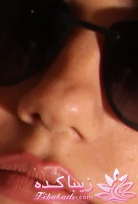 جراحی بینی - جراحی زیبایی