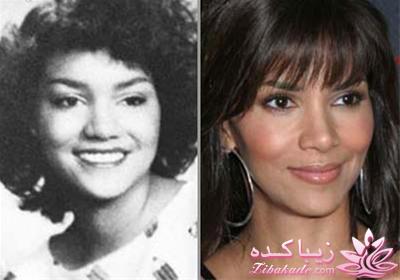 جراحی بینی - جراحی زیبایی