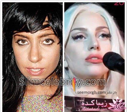 جراحی بینی - جراحی زیبایی