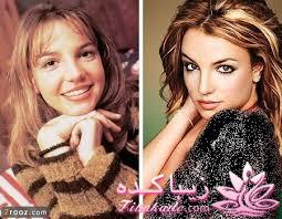 جراحی بینی - جراحی زیبایی