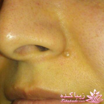 مشاوره زیبایی