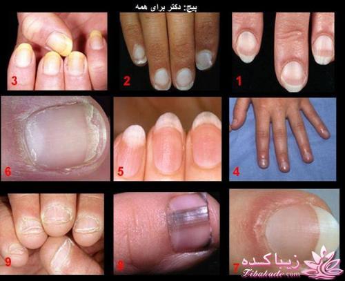 مراقب سلامتی خود باشید