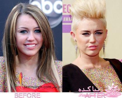 جراحی بینی - جراحی زیبایی