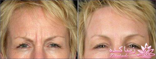 معرفی بهترین کلینیک زیبایی - بهترین دکتر جراح زیبایی