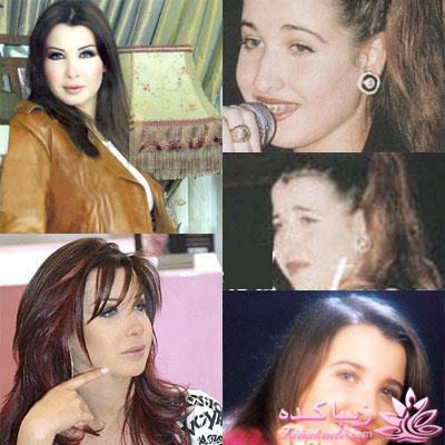 جراحی بینی - جراحی زیبایی