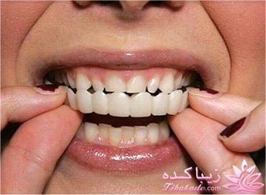 جراحی ایمپلنت